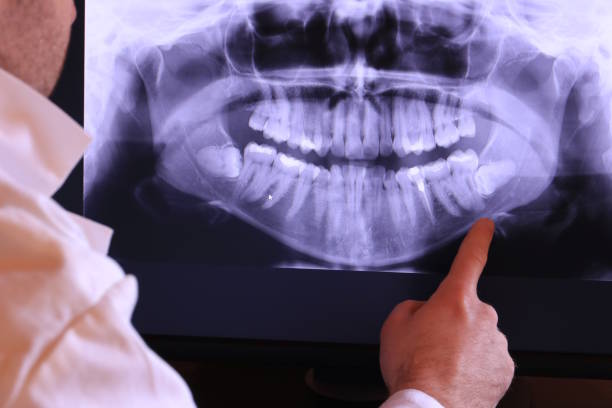 Best Emergency Treatment for Dental Infections or Abscesses in Menomonie, WI