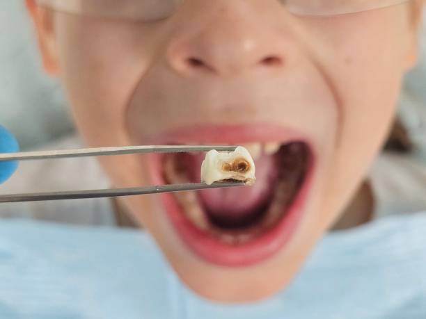 Best Emergency Denture Repair in Menomonie, WI